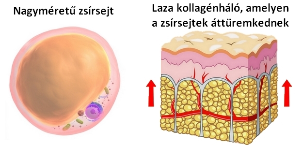 Hatalmas üzlet a fogyás - Miért sikertelen a próbálkozások többsége? | VEOL, Fiatalember fogyás